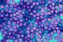 Hepatitis A virus under microscope